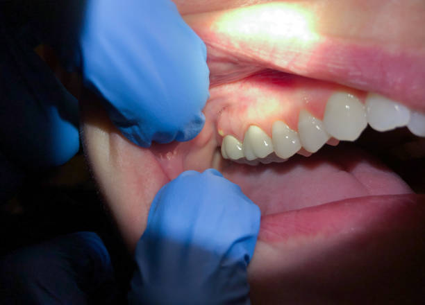 Best Weekend Emergency Dentist in Spencerville, NM
