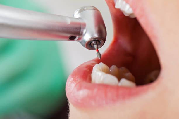 Best Weekend Emergency Dentist in Spencerville, NM